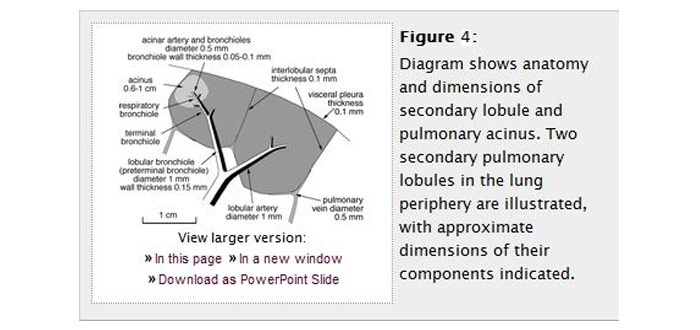 CT Paterns of Abnormality and Anatomic Distribution 3