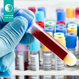 قبل از آزمایش خون چند ساعت ناشتا باشیم؟