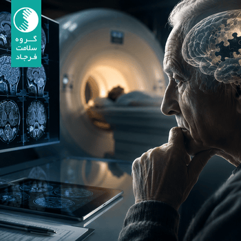 آلزایمر