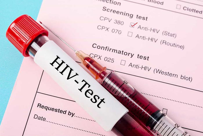 روز مشاوره و آزمایش اچ آی وی - اچ ای وی - گروه تشخیصی درمانی فرجاد - فرجاد - HIV