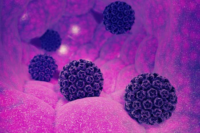 hpv - اچ پی وی - زگیل تناسلی - گروه ?????? ????? - فرجاد قم - فرجاد 