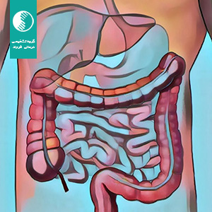 سندرم روده تحریک پذیر چیست؟